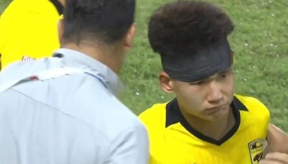 九游娱乐官方网站-广州豹官方：杨浩眉弓伤口缝合30余针，预计将在5-7天后拆线